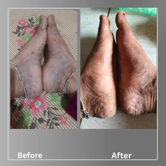 Before and after — skin and hand healing at Sweet Pills Clinic